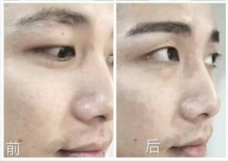 欧美种植眉毛视频大全集